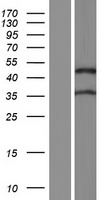 ls118813 zfyve27 human over expression lysates nm 001174121 wb testing 6