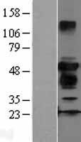ls118813 zfyve27 human over expression lysates nm 144588 wb testing 2
