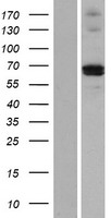 MMP21 Human Over-expression Lysates NM_147191
