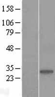 COMTD1 Human Over-expression Lysates NM_144589