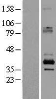 SFXN2 Human Over-expression Lysates NM_178858