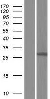 GSTO2 Human Over-expression Lysates NM_001191015