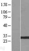 GSTO2 Human Over-expression Lysates NM_183239