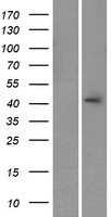 ls119395 calhm3 human over expression lysates nm 001129742 wb testing 1
