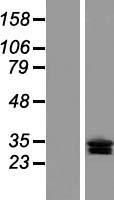 CLRN3 Human Over-expression Lysates NM_152311