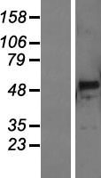 ls119548 pnliprp3 human over expression lysates nm 001011709 wb testing 1