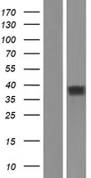 OR52K2 Human Over-expression Lysates NM_001005172