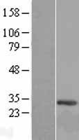 C12orf45 Human Over-expression Lysates NM_152318