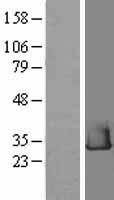 RHEBL1 Human Over-expression Lysates NM_144593