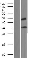 ZNF641 Human Over-expression Lysates NM_001172682