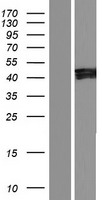 IKIP (IKBIP) Human Over-expression Lysates NM_201612