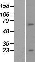 ls121551 btbd11 human over expression lysates nm 152322 wb testing 1