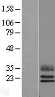 TEX29 Human Over-expression Lysates NM_152324