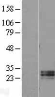 RNASE11 Human Over-expression Lysates NM_145250