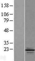 ls122664 tppp2 human over expression lysates nm 173846 wb testing 1