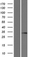 SLC25A29 Human Over-expression Lysates NM_001039355