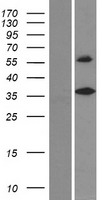 ls123099 degs2 human over expression lysates nm 206918 wb testing 1