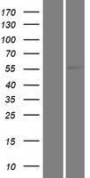 KLHL33 Human Over-expression Lysates NM_001109997