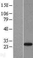 SENP8 Human Over-expression Lysates NM_145204