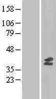 MTFMT Human Over-expression Lysates NM_139242