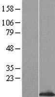 ls123264 ost beta slc51b human over expression lysates nm 178859 wb testing 1