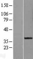 ls123355 lrrc28 human over expression lysates nm 144598 wb testing 1