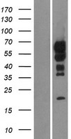 C15ORF27 (TMEM266) Human Over-expression Lysates NM_152335