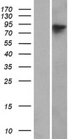 WHAMM Human Over-expression Lysates NM_001080435