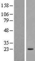 ls123811 cep20 human over expression lysates nm 144600 wb testing 1