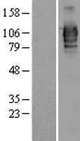 LRRC50 (DNAAF1) Human Over-expression Lysates NM_178452