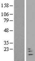 NRN1L Human Over-expression Lysates NM_198443