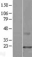 CMTM3 Human Over-expression Lysates NM_144601