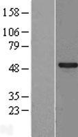 SPATA2L Human Over-expression Lysates NM_152339