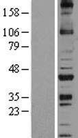 ls124056 noxo1 human over expression lysates nm 144603 wb testing 1