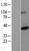 ANKRD26P1 Human Over-expression Lysates NM_001004299