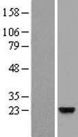 ZG16B Human Over-expression Lysates NM_145252