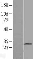 PAQR4 Human Over-expression Lysates NM_152341
