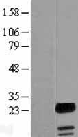UBALD1 Human Over-expression Lysates NM_145253