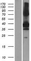 SNX20 Human Over-expression Lysates NM_182854