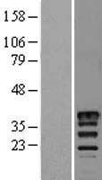 MSI2 Human Over-expression Lysates NM_138962