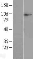 SLC38A10 Human Over-expression Lysates NM_138570