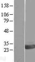 ls124641 ovca2 human over expression lysates nm 080822 wb testing 1