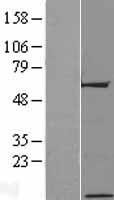 C17orf64 Human Over-expression Lysates NM_181707