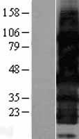 HEXIM2 Human Over-expression Lysates NM_144608