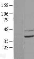 CNTD (CNTD1) Human Over-expression Lysates NM_173478