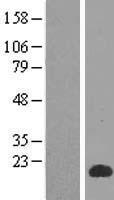 SPACA3 Human Over-expression Lysates NM_173847