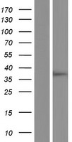RSKR Human Over-expression Lysates NM_001174103