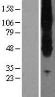 SLC43A2 Human Over-expression Lysates NM_152346