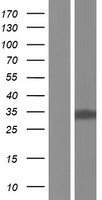 CYB5D2 Human Over-expression Lysates NM_144611