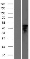 ls124975 ggt6 human over expression lysates nm 153338 wb testing 1